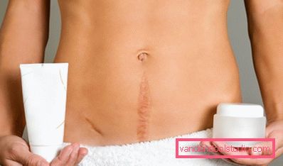 sredstva za brazgotine sredstva za brazgotine
