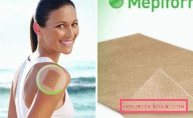 Mepiformni obliž Mepiformni obliž