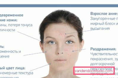 simptomi stresa na koži simptomi stresa na koži