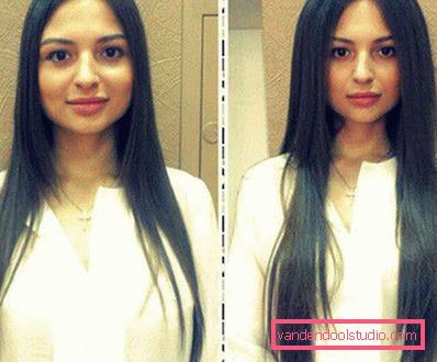 Radikalen volumen las Boost Up (Boost UP) - vse o postopku