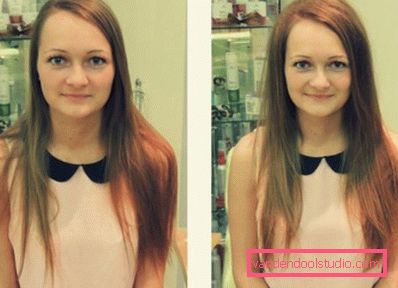 Radikalen volumen las Boost Up (Boost UP) - vse o postopku