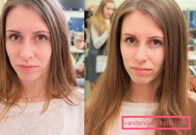 Radikalen volumen las Boost Up (Boost UP) - vse o postopku