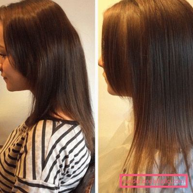 Radikalen volumen las Boost Up (Boost UP) - vse o postopku