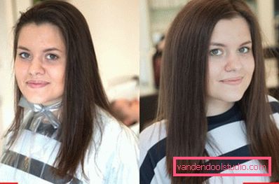 Radikalen volumen las Boost Up (Boost UP) - vse o postopku
