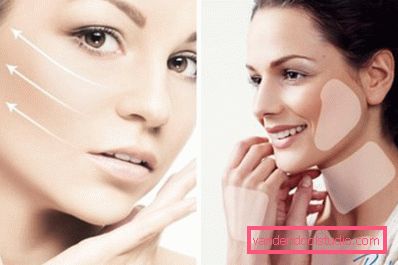 Restylane pomlajevanje Restylane pomlajevanje