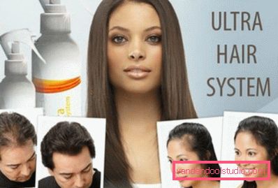 zdravljenje alopecije zdravljenje alopecije