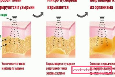 akcijskega načrta akcijskega načrta